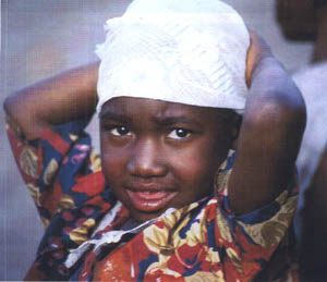 bimba del Malawi